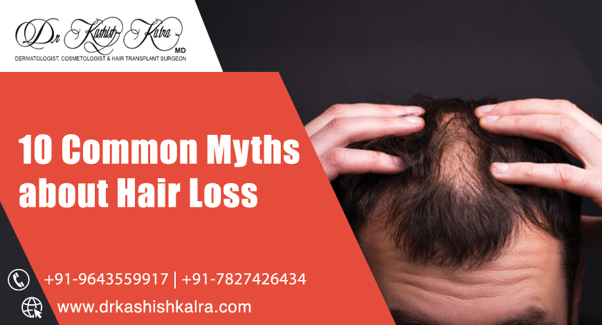 Common myths about hair loss